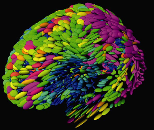 Composite image of brain MRIs