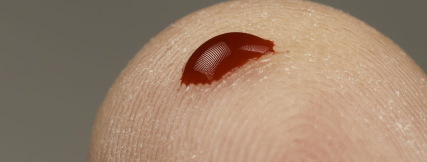 Blood drop on a finger. There are many key questions to ask before DTC testing.